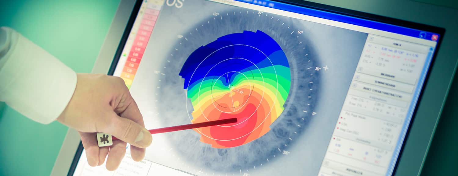 Corneal Crosslinking in Queens, NY