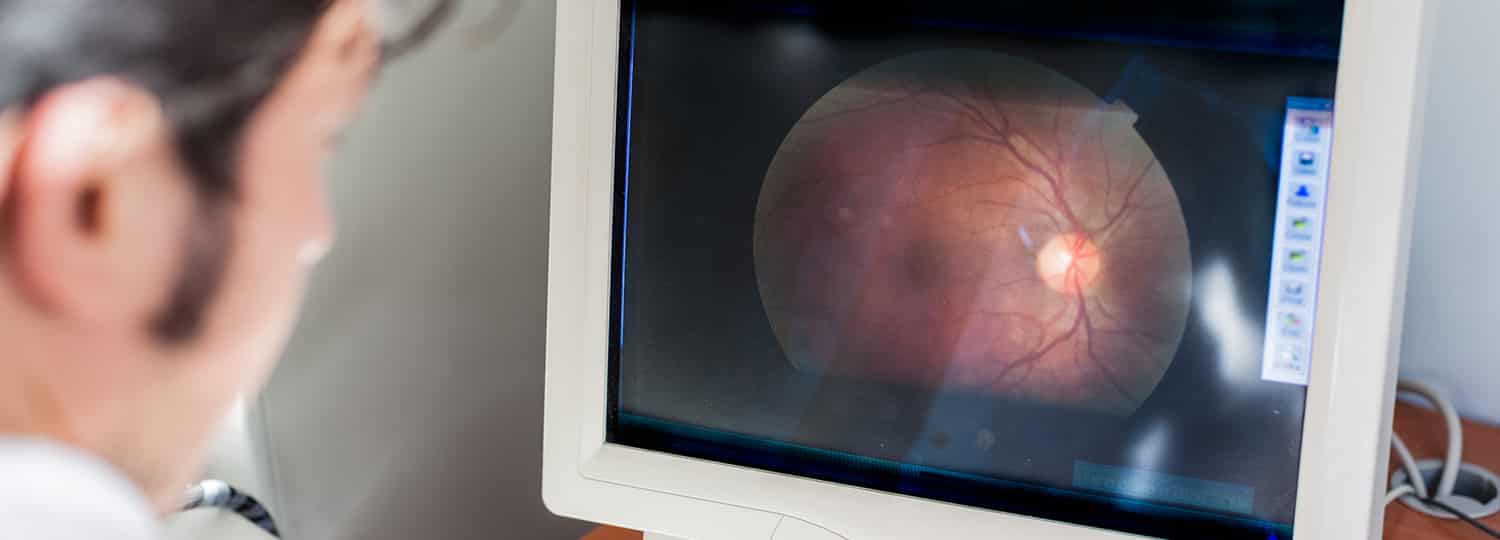 Retina Treatment in Queens, NY